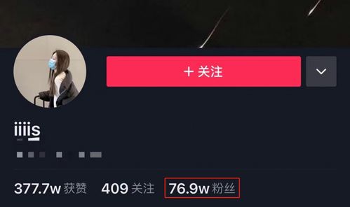 抖音粉丝徽章如何有效去除？详细教程分享